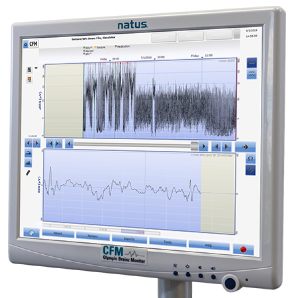 Olympic Brainz Monitor Angle Screen Trace Pattern3 Spot 0 (1)